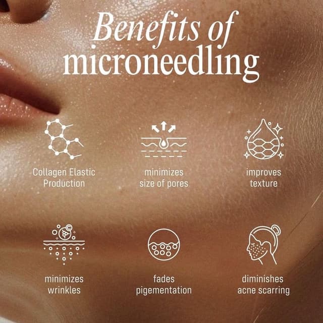 Microneedling Bundle at Taylor Made Skyn in Dickinson, TX